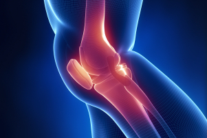 Improving Outcomes of Posterolateral (PLC) Knee Injuries