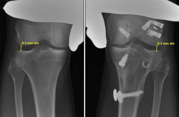 Bilateral X-ray